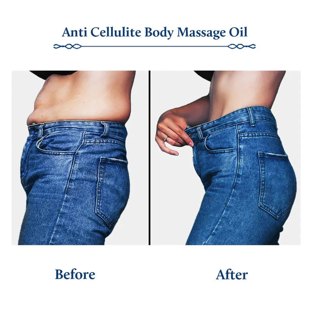 Blue Nectar Triphaladi Ayurvedic Fat Burning & Slimming Oil (11 Herbs) - 100ml