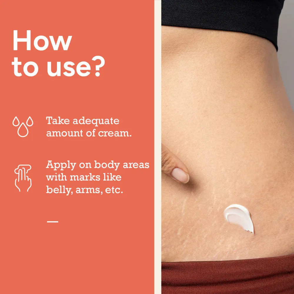 Citta Stretch Marks Cream | Shea & Cocoa Butter Blend with Vitamin E for Smooth, Elastic Skin
